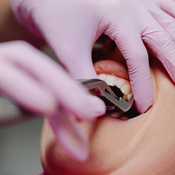 General Dentistry